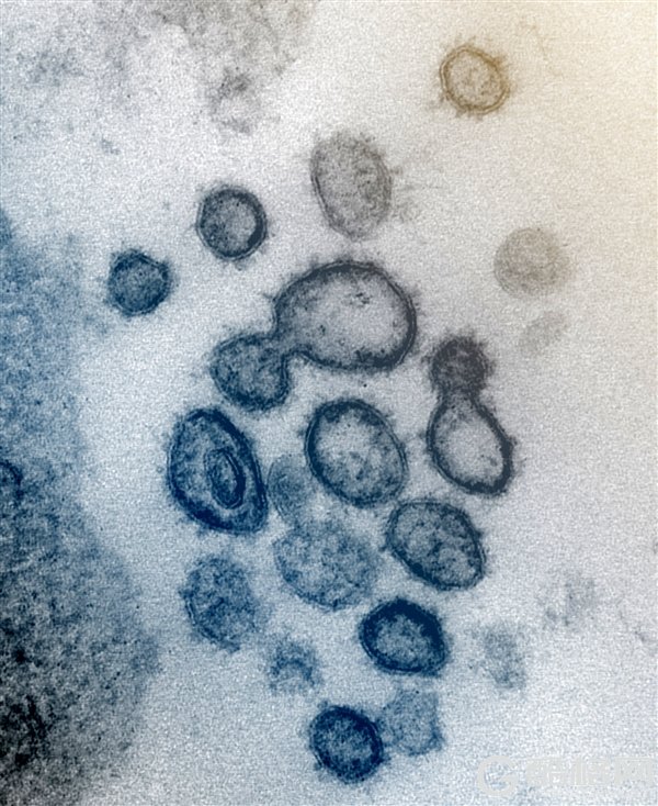 新冠病毒显微镜彩照首度公布！与MERS和SARS相似