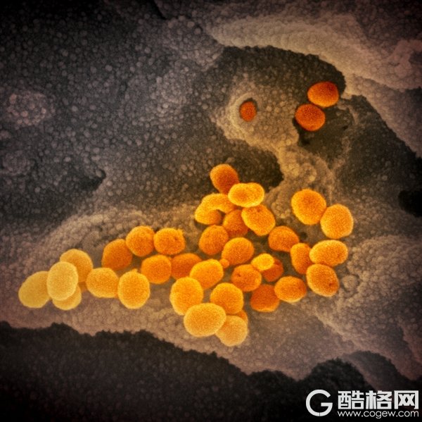 新冠病毒显微镜彩照首度公布！与MERS和SARS相似